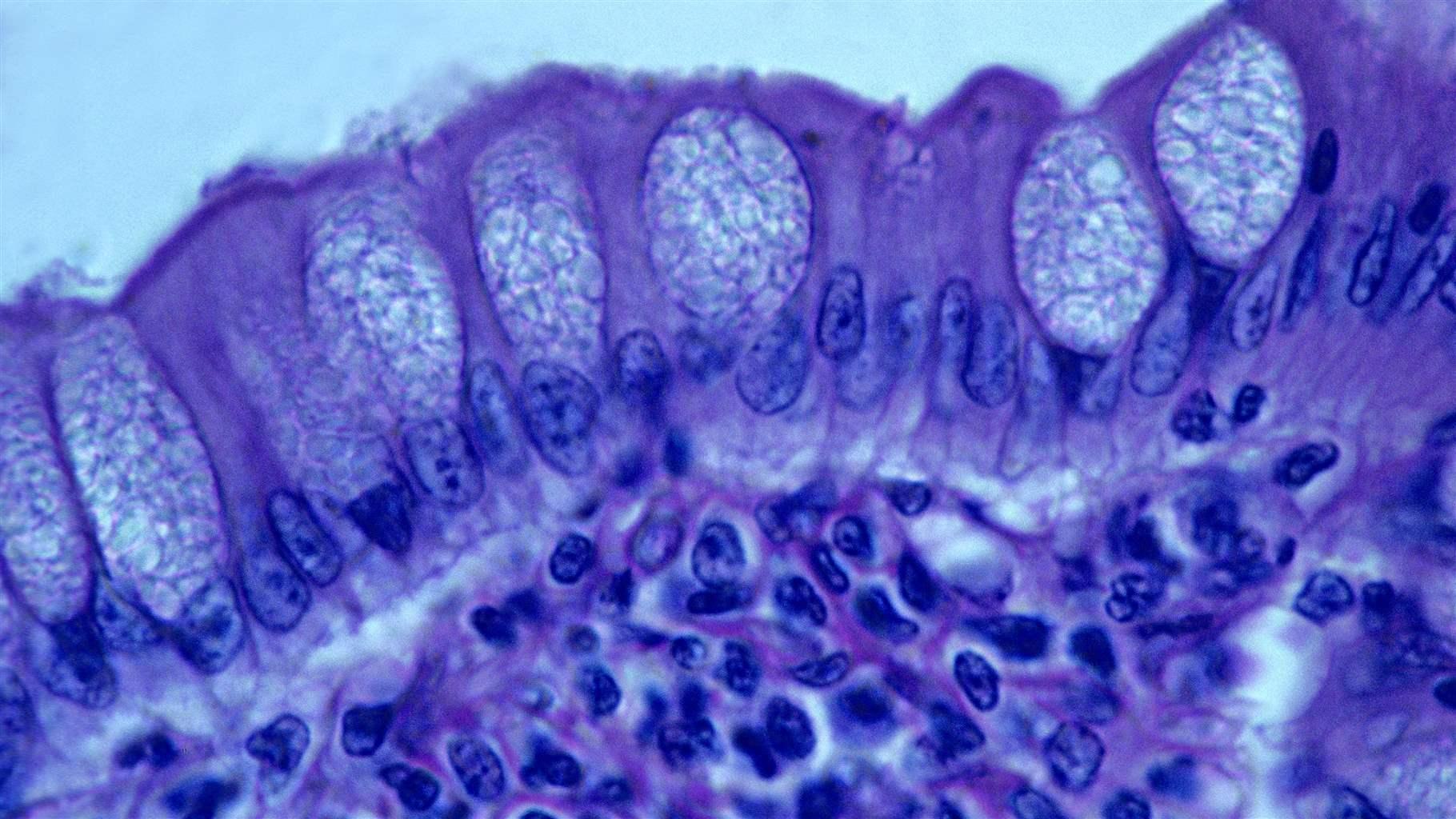 A Small Worm Offers Big Clues About the Human Immune System